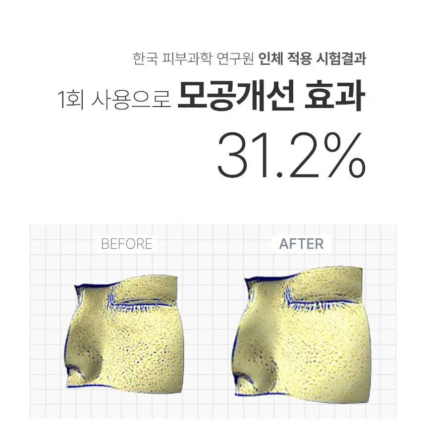 [모공개선] 유리숲 모델링팩 1회분 상세페이지 22